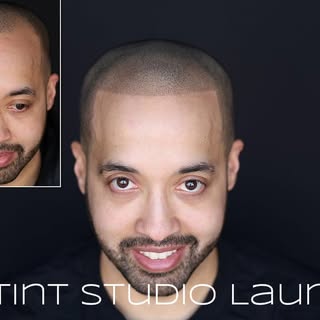 YES, THIS IS A HAIR TATTOO 😍 

Scalp micropigmentation is a realistic hair tattoo that will give yo