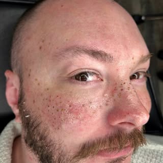 "Those freckles make you seem like a galaxy of stars, just waiting to be explored and loved" 🌠

Yes