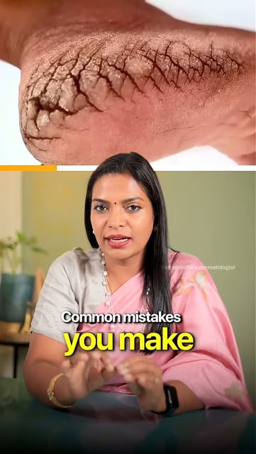 Are You Making These Foot Care Mistakes?

#FootCare #CrackedHeels #HeelCare #DryFeet #HealthyFeet

[