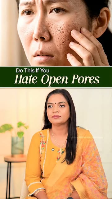Comment “PORES” to learn how to reduce their appearance! 

#OpenPores #LargePores #PoreCare #Collage