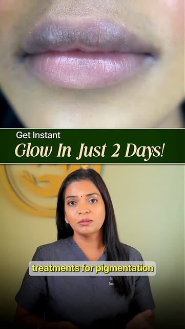 Pico Laser: How Does It Reduce Pigmentation?

#PicoLaser #Pigmentation #DarkLips #TanRemoval #DarkSp