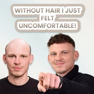 Patrick shares how it felt to lose his hair. 😱😰😨

Book a free consultation: 
Visit www.totalcover