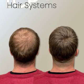 ✅ Clarity, care, and stunning results. That’s the Total Cover Plus promise for your hair.

🇺🇸
www.