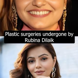 Plastic Surgeries that Rubina Dilaik underwent! 
~
Watch the full video to know how she looks so dif