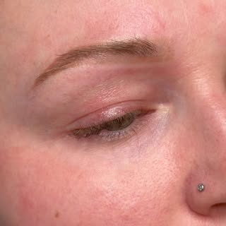 Sometimes the best brow transformation starts with a fresh canvas. 🤎

We removed to soften and eras