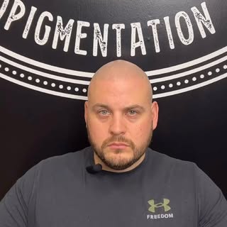 Check out our latest client Brandon as he gives a video testimonial of his issues with hair loss at 