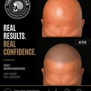 From bald to bold. 💀🔥

Natural-looking scalp micropigmentation designed to restore confidence and 