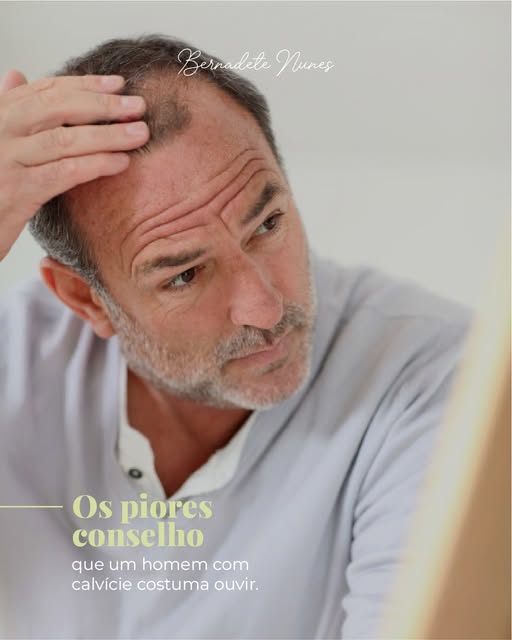 Nem todo homem quer resolver a calvície.
Mas quem quer, merece saber que existem opções.