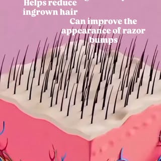 Benefits of laser hair reduction ✨
.
.
.
#laserhairreduction #smoothskin #skincare