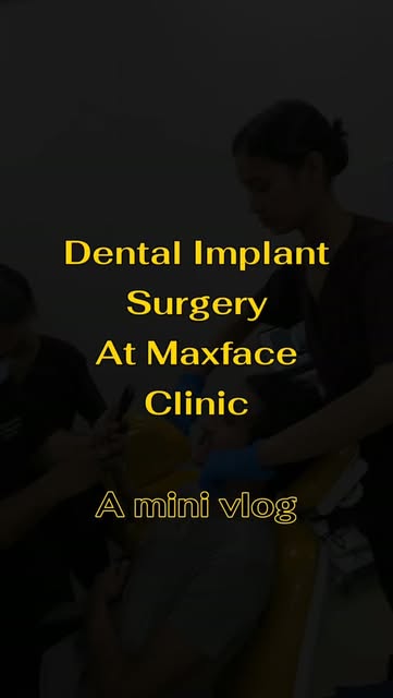 🦷A sneak peak into dental implant surgery procedure 🦷🦷
#dentalimplants #maxface_clinic