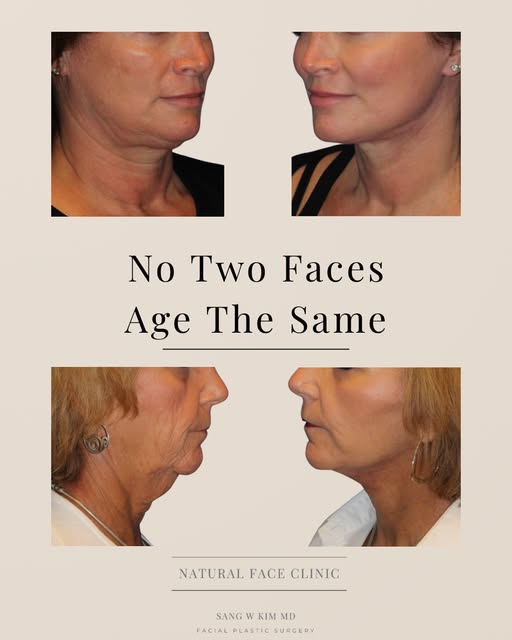 No two faces age the same, and facial rejuvenation shouldn’t follow a one-size-fits-all approach. Ev