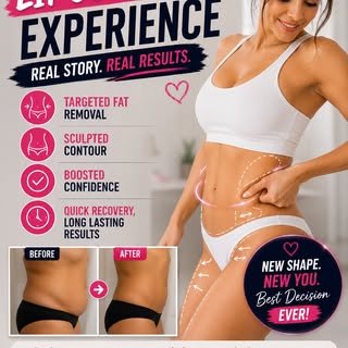 My Liposuction Experience: The Journey to a More Confident You

Thinking about liposuction but wonde