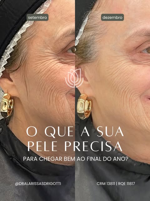 Se você quer chegar ao final do ano com uma pele mais uniforme, viçosa e com mais qualidade, setembr