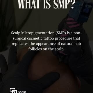 What is SMP? It’s a life changing, confidence boosting procedure for men and women. Message me anyti
