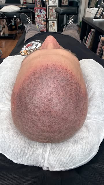 Fixed up a pretty poor attempt at SMP today for a client I tattooed about 9 years ago. We got a mass