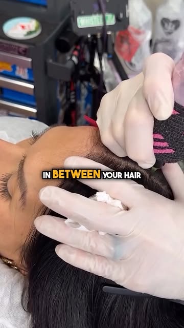 Thinning hair doesn’t always mean you need to shave it all off. Density SMP can help reduce scalp vi