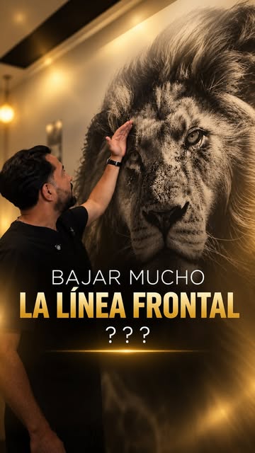 ¿Y bajar mucho la línea frontal? ¿Qué puede pasar? 👀

En un injerto capilar, diseñar una línea dema