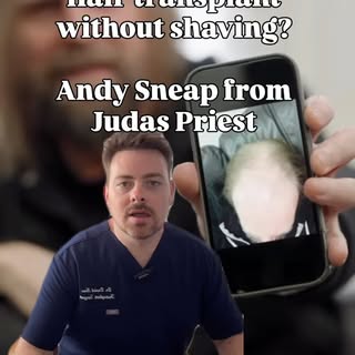 Can you have a hair transplant without shaving your head?

Even if your hair is long, thick and the 