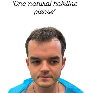 A novice surgeon adds some hair 

But the expert thinks about the whole face 

Delighted to showcase