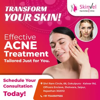 ✨ Say goodbye to acne and hello to clear, glowing skin! ✨

At Skinvel Hair & Skin Clinic , we offer 