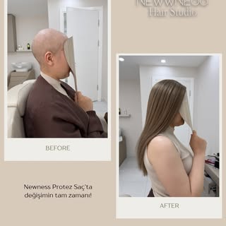 Bazı güzellikler sadece aynada değil, yeniden gülümseyen bir yüzde saklıdır. 🤍

Newness olarak, saç