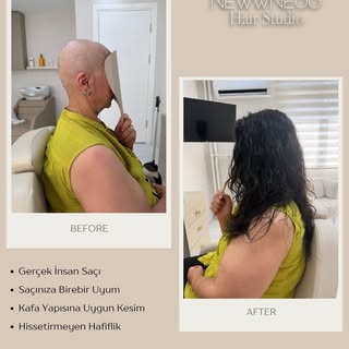 Newness Protez Saç’ın kadın protez saç çözümleriyle seyrelme, bölgesel saç kaybı ve hacim eksikliği 