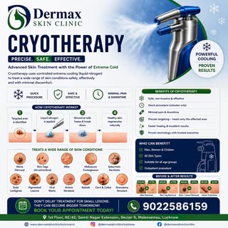❄️ Freeze the problem. Save your skin.
Cryotherapy is a quick, safe and effective treatment that use