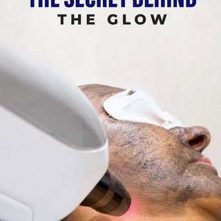 CARBON LASER ✨ | THE GLOW-UP YOUR SKIN DESERVES
Dull skin? Uneven texture? Excess oil? Visible pores