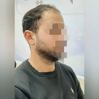 @menshairworld 
@moulian.hr 
@hair