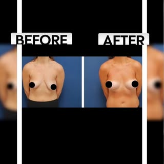 ✨ The wait is over!

Last week, we shared our patient’s reaction… and now it’s time to see the resul