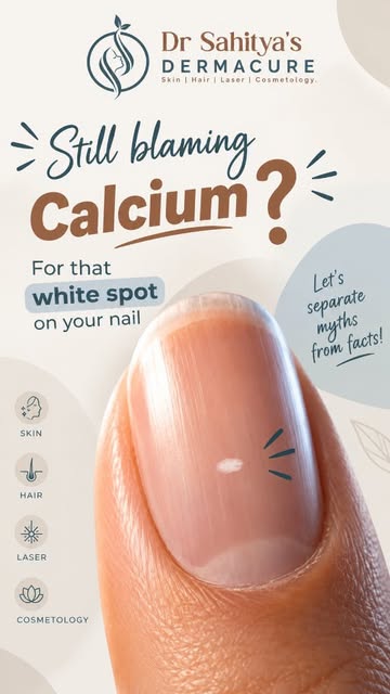 Still blaming calcium for that little white spot on your nail? 👀
Here’s the truth: white spots on n
