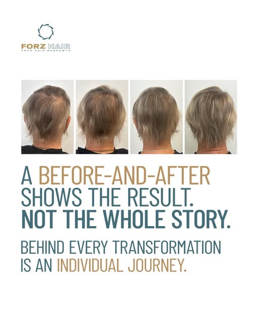 Before-and-after photos get attention because they make change visible in seconds. But two images do