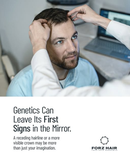 Genetic hair loss doesn’t always begin with large amounts of hair falling out. With androgenetic alo