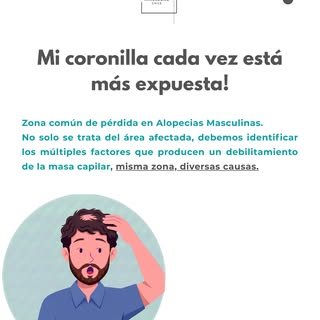 Recuerda! No toda alopecia masculina es netamente genética o hereditaria, influyen diversos factores