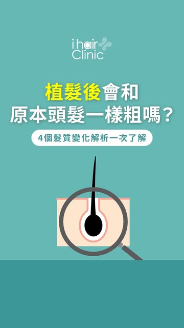 植髮後頭髮會一樣粗嗎？掌握4大關鍵了解新生髮質變化
- 
植髮後剛長出來的新生髮
看起來細細短短、甚至有點微捲
讓您開始焦慮毛囊到底有沒有好好長大嗎❓
ihair風華御髮請您先放寬心！
植髮遵循「供髮