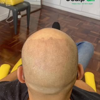 1st session going in…

Happy days are here again!

https://www.scalpdr.co.za

Call us at Scalp Dr. C