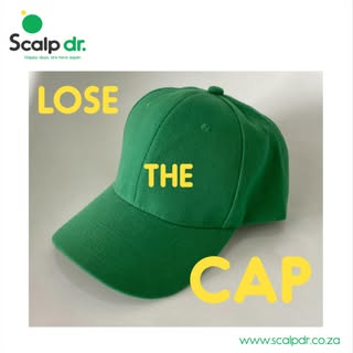 Scalp Micropigmentation is a non invasive hair loss solution which can give the look of a full head 