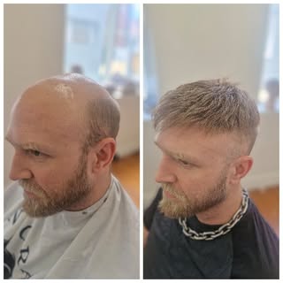 🔥 “New Hair, New Confidence.”
💈 “Melbourne’s #1 Men’s Hair System Specialists.”
✨ “From Thin to Fu
