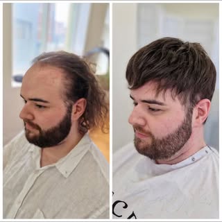 Natural. Undetectable. Made for you.

Our men’s hair units at Melbourne Human Hair Extensions are al