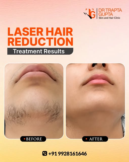 ✨ Smooth Skin Starts Here ✨

Tired of unwanted hair and constant shaving or waxing? Experience profe
