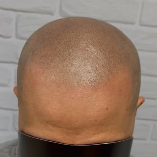 Another great result!! 👍🏻 #smp #scalpperfect #scalpmicropigmentation #scalpuk #scalpberkshire