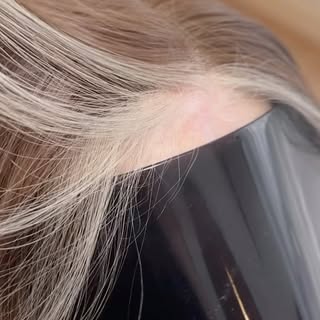 Hair restoration should always work with your natural hair, never against it!

In the past, this cli