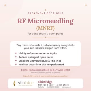 ✨ Treatment Spotlight: RF Microneedling (MNRF) ✨

Struggling with acne scars, pitted marks or enlarg
