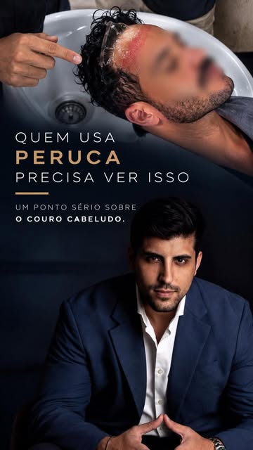 Usar peruca ou prótese capilar pode parecer apenas uma solução estética. Mas o que acontece por baix