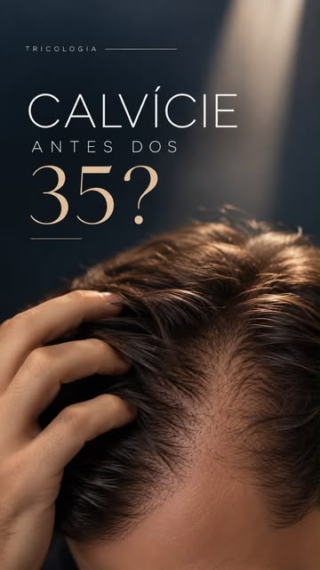 Ninguém quer ficar calvo. Mas perceber as entradas aumentando ou o cabelo ficando mais ralo pode tra