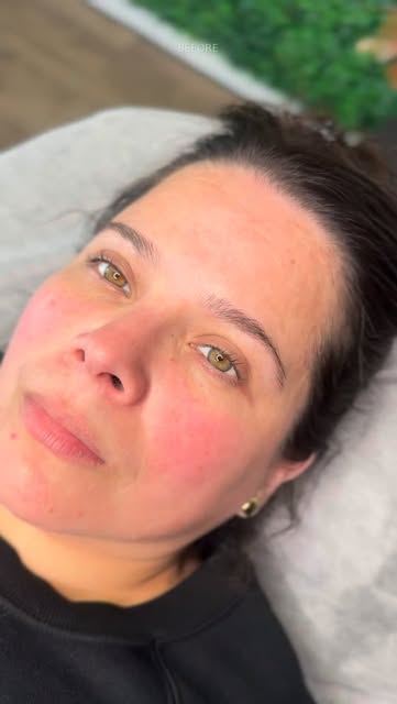 THIS is why I love Lip Blush. 💋

Look at her lips before… and then look at that finished color.

We