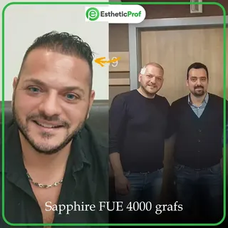 On this Transformation we're excited to share the amazing results of a hair transplant! Our medical 
