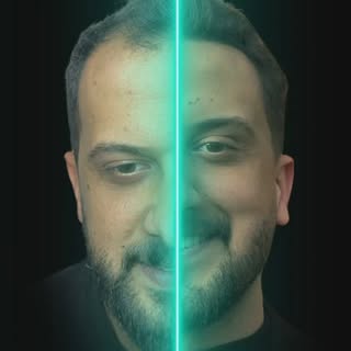 Assem Saç Ekim Danışmanlığı olarak, en son teknolojiler ve uzman ekibimizle doğal ve kalıcı saç ekim
