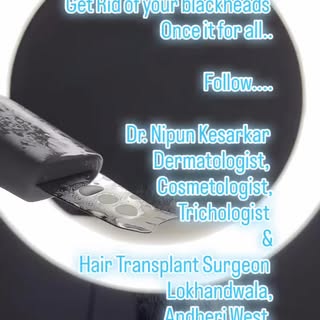 Glowing Skin in Summer,
Hydra facial... 
Uneven skin tone..
Skin care..