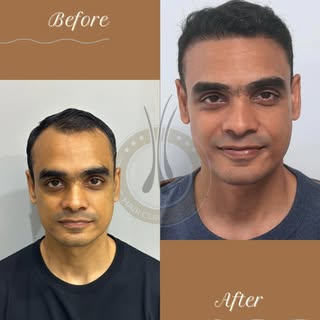 ✨ **Real Results. Real Confidence.** ✨

Witness the incredible transformation achieved at **Hair Cli
